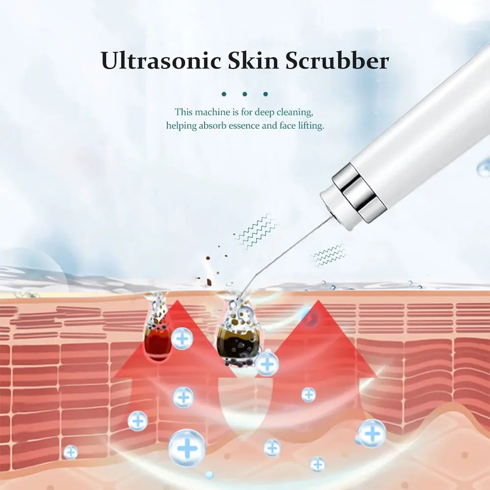 Ultrasonic Electric Skin Scrubber Blackhead Removal