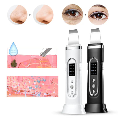 Ultrasonic Electric Skin Scrubber Blackhead Removal