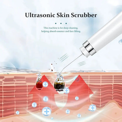 Ultrasonic Electric Skin Scrubber Blackhead Removal